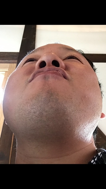 １８