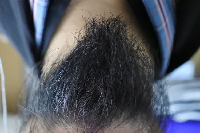 g6